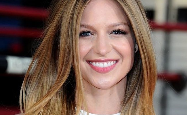 Melissa Benoist
